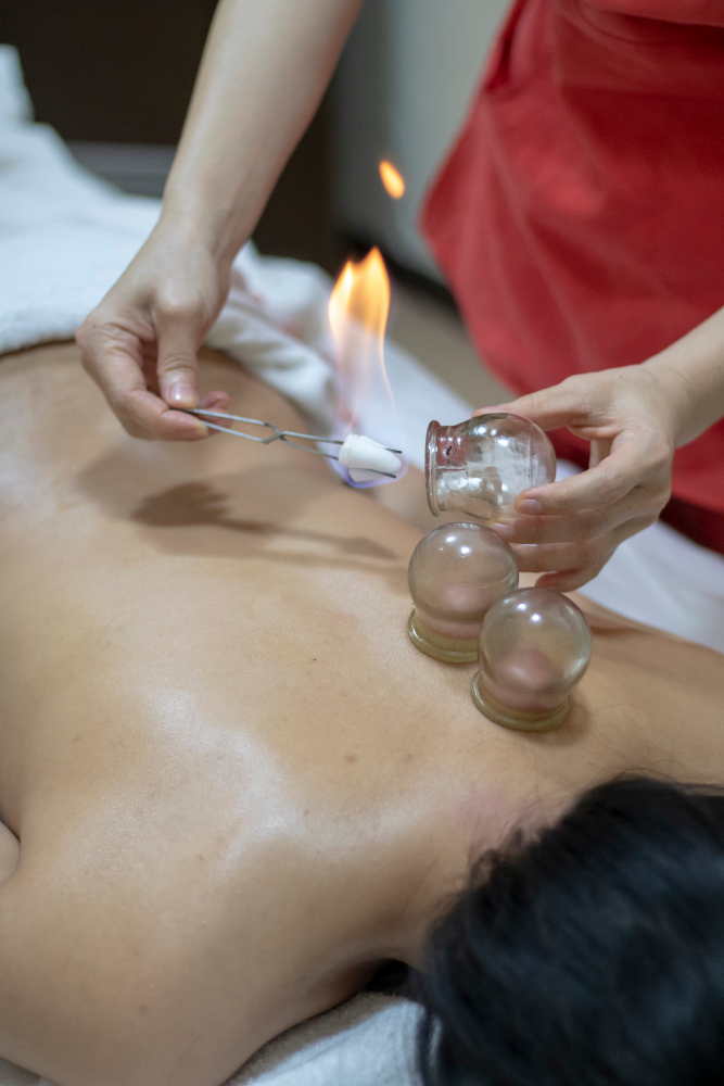 Cupping Therapy Services