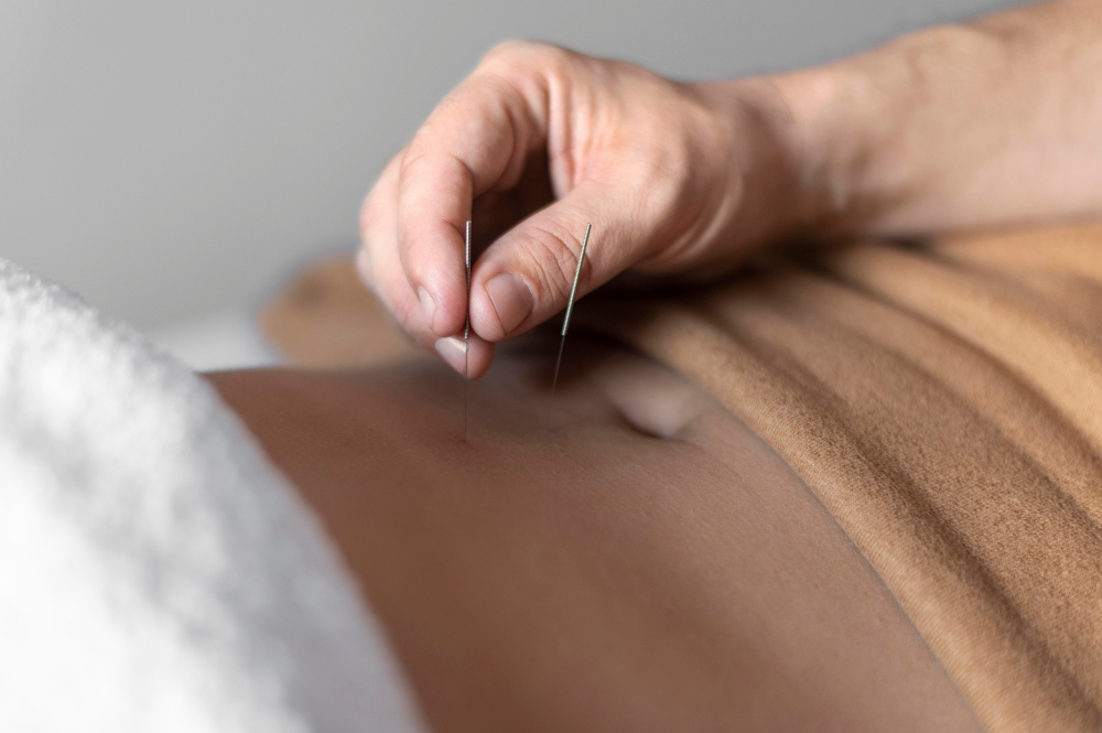 Acupuncture for Digestion
