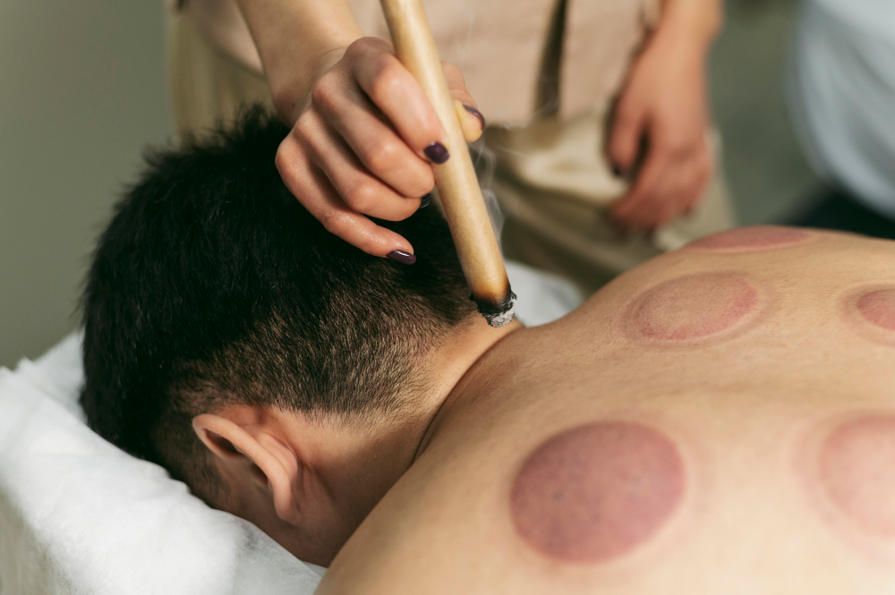 Moxibustion Therapy Service