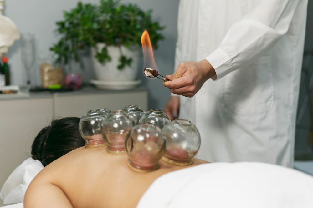 Cupping Therapy Services