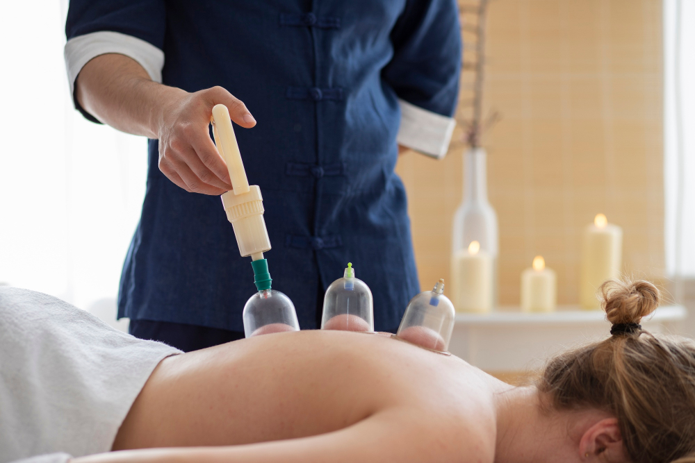 Cupping Therapy Services