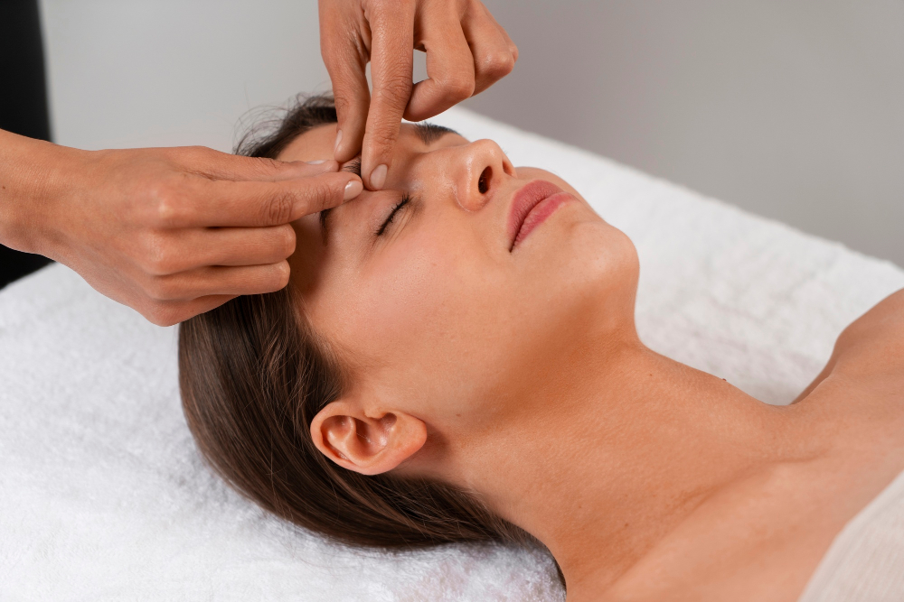 Acupuncture for Migraines