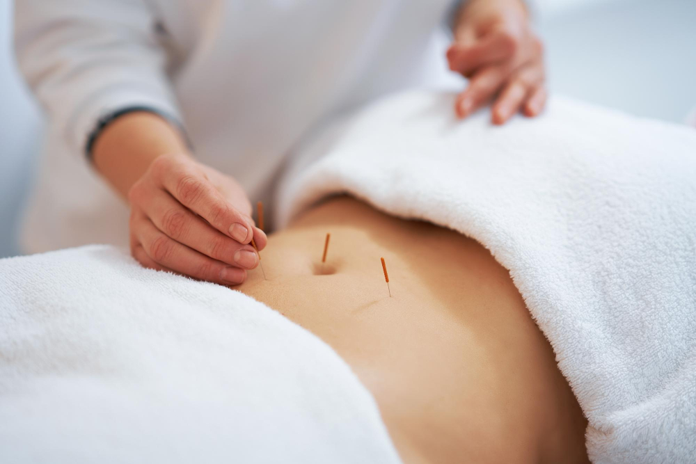 Acupuncture for Digestion
