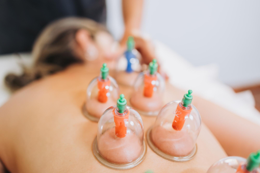 Cupping Therapy Services