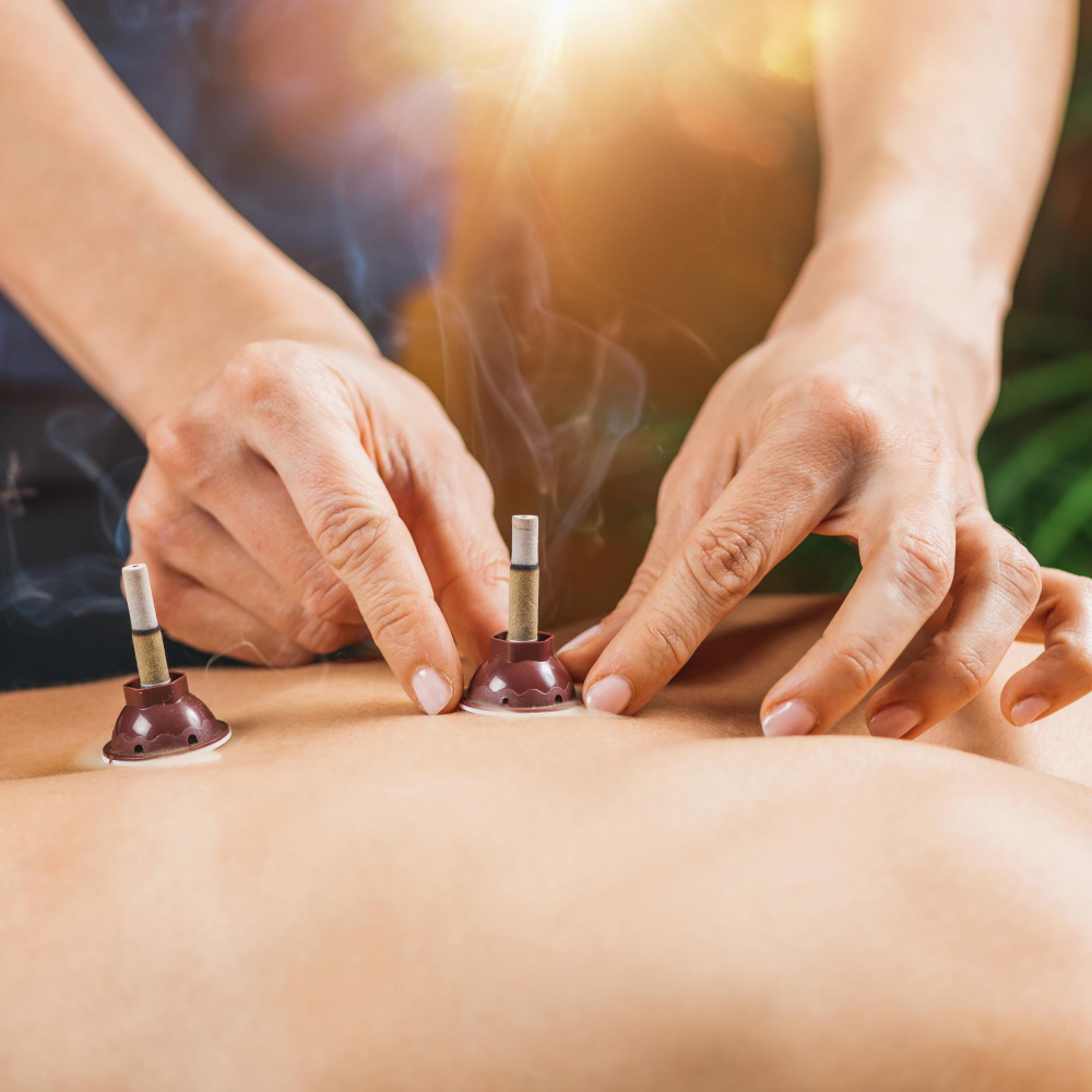 Moxibustion Therapy Service