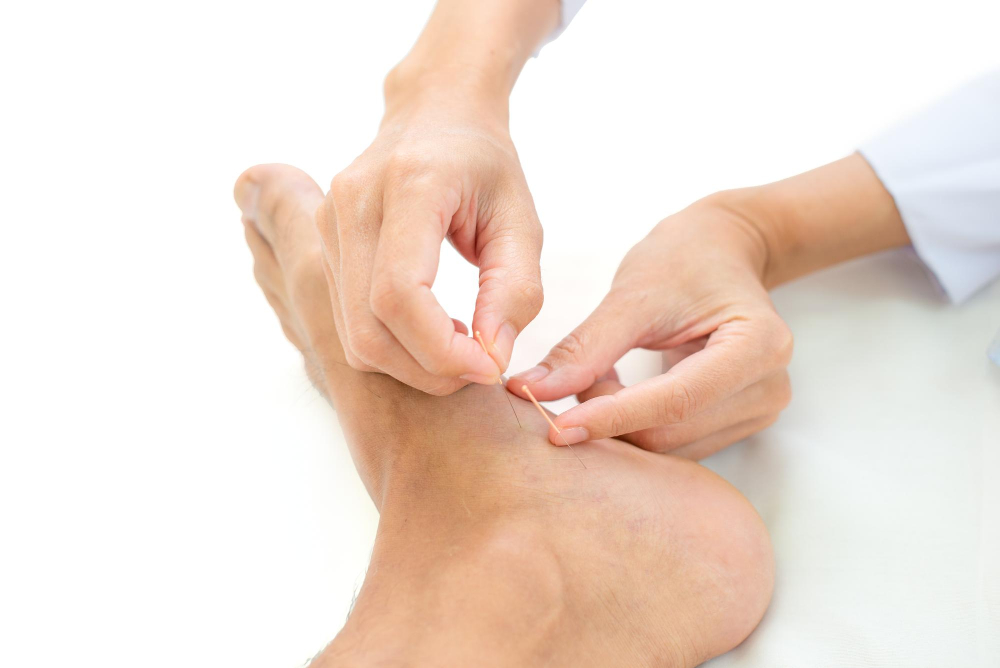 Neuropathy Treatment