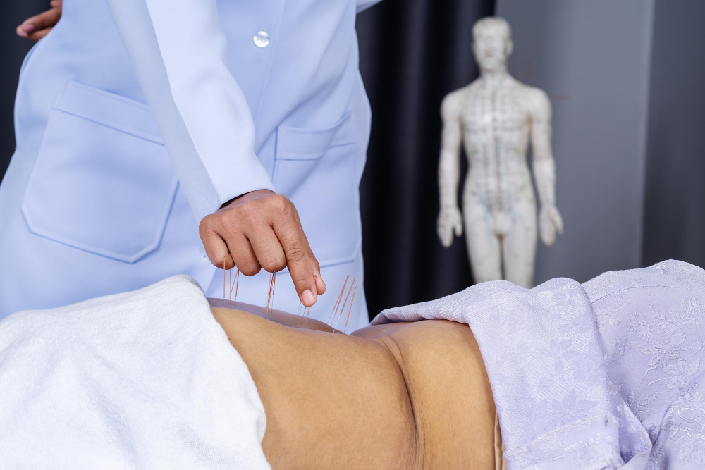 Acupuncture for Digestion