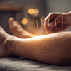 Acupuncture Service for Improves circulation