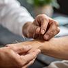 Acupuncture Service for Regulates blood pressure