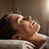 Acupuncture Service for Stress & Anxiety Relief