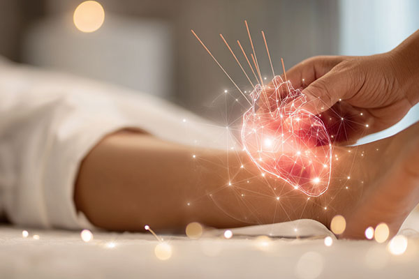 How Acupuncture Supports Heart Health
