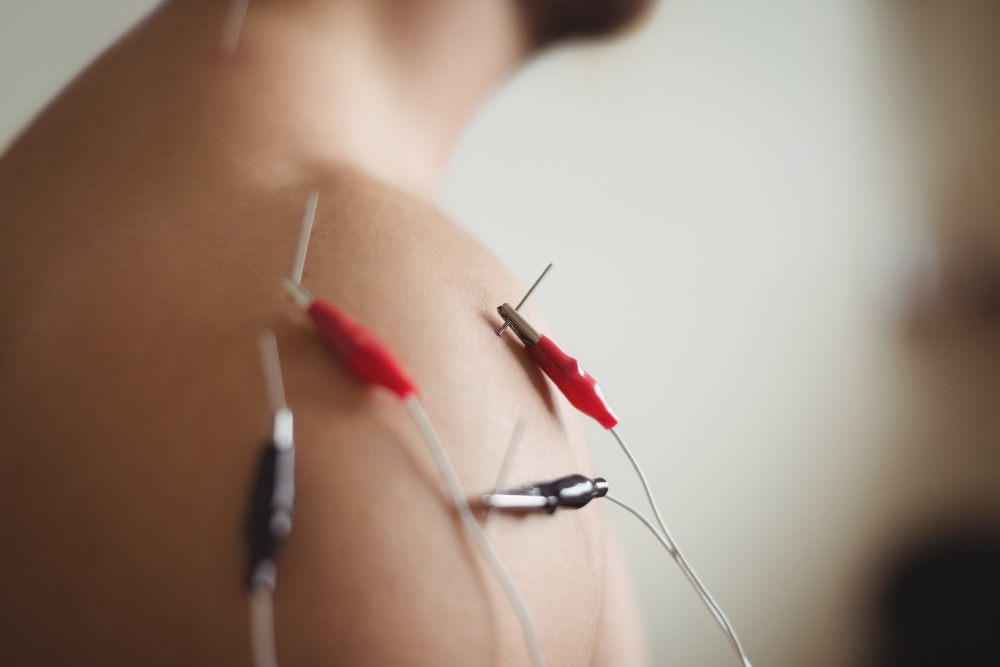 Acupuncture Supports Respiratory Health